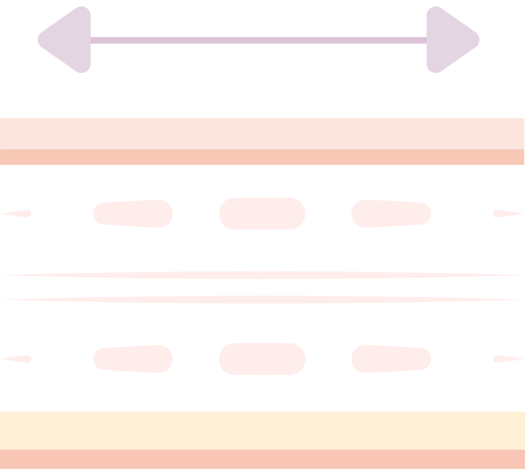 RHA4
