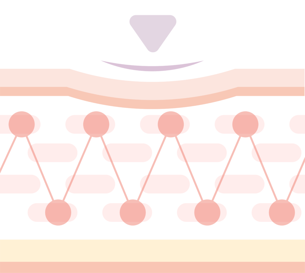 RHA4
