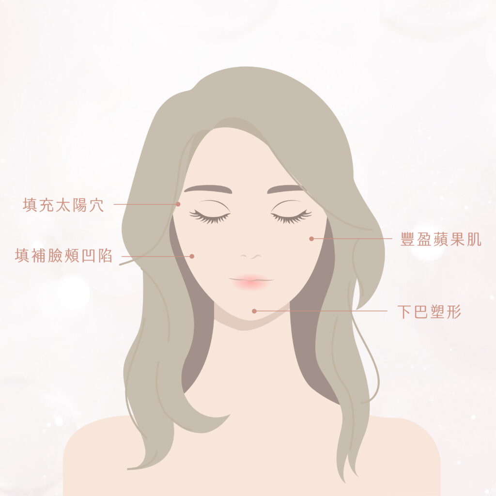 RHA4填充位置