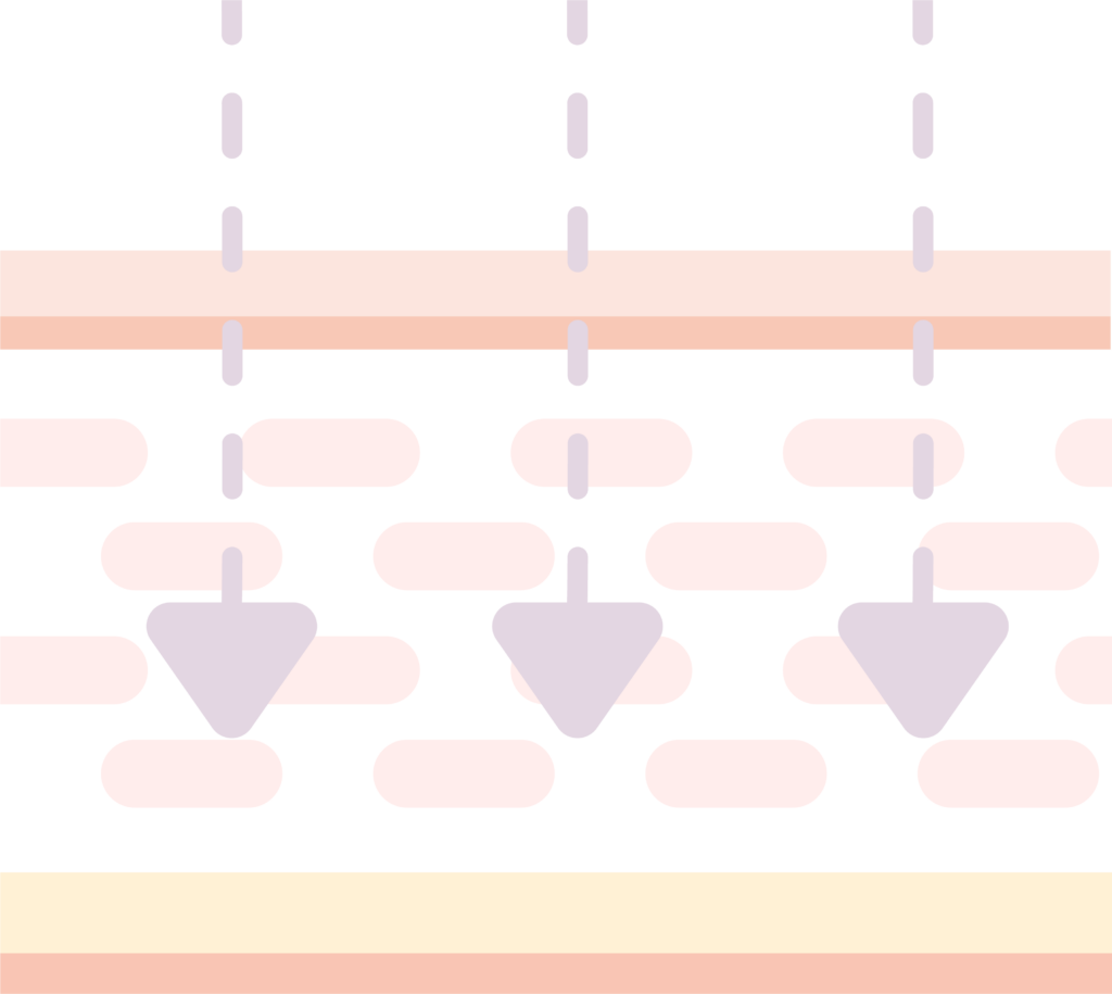 RHA4