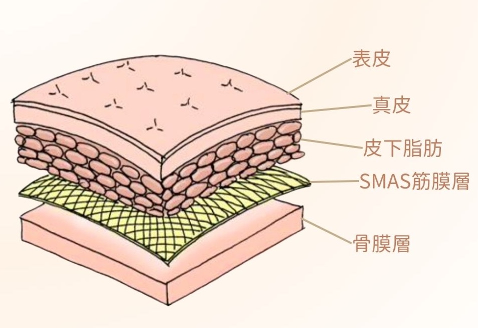 SMAS肌腱膜