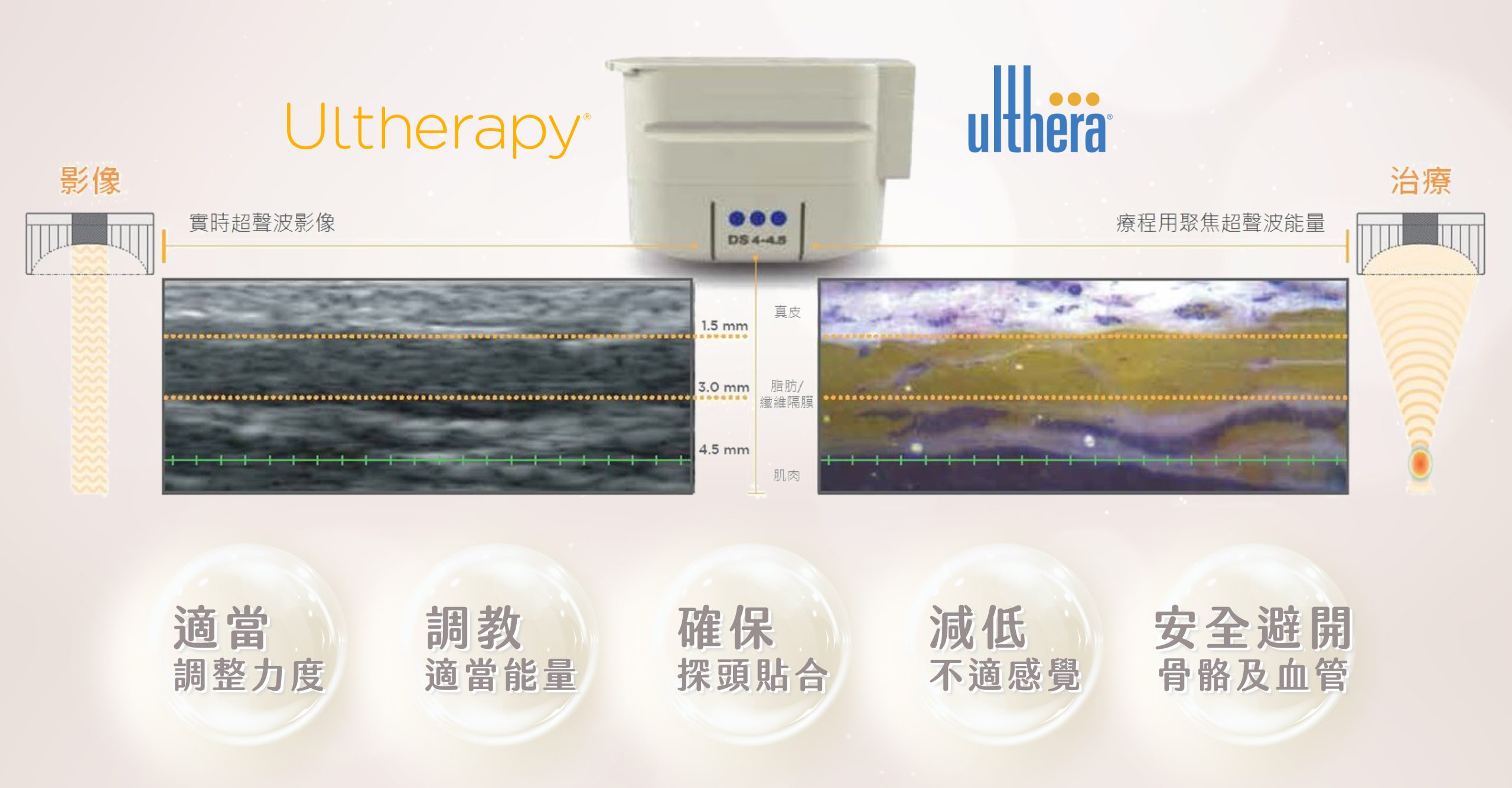 Ultherapy®實時影像技術
