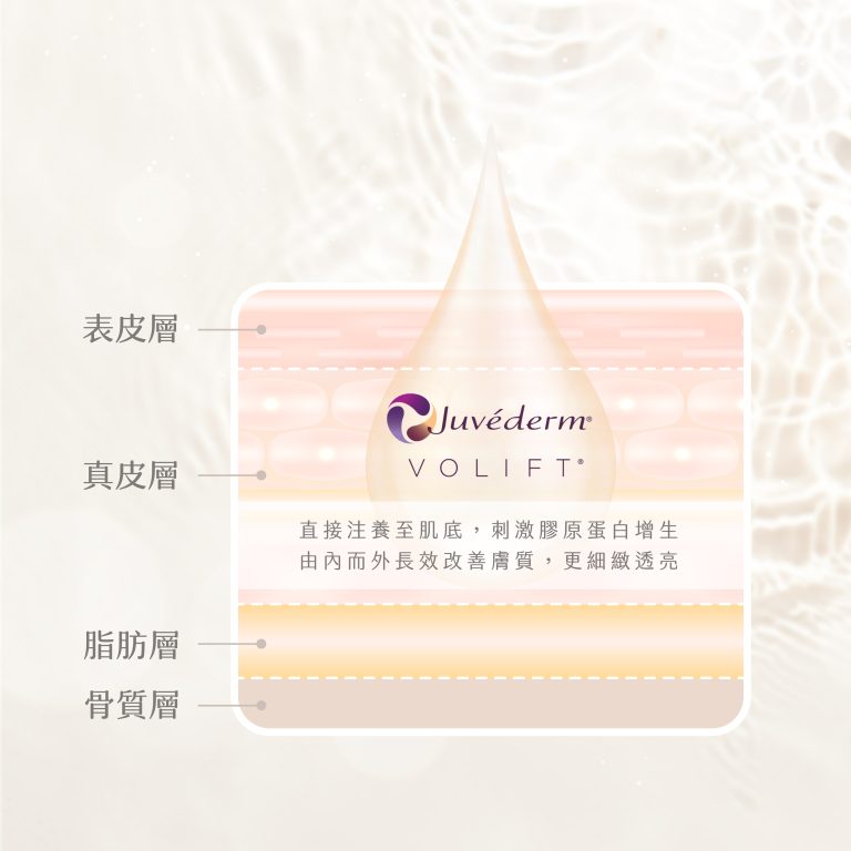 Juvéderm® Volift™主要功效