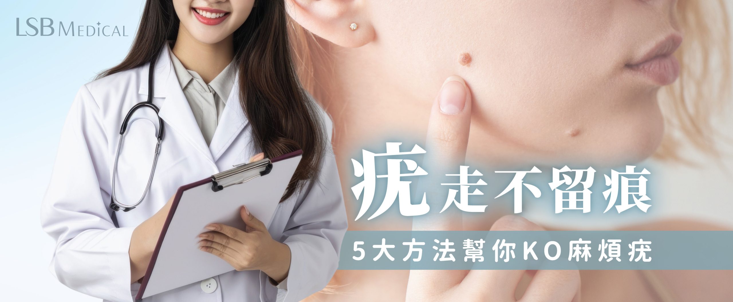脫疣方法