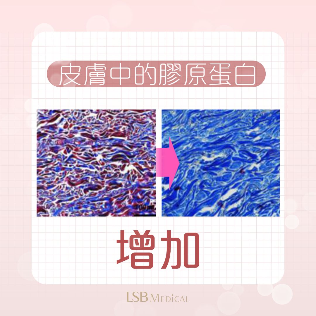 Lilied M