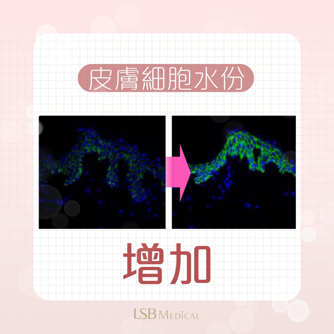 Lilied M