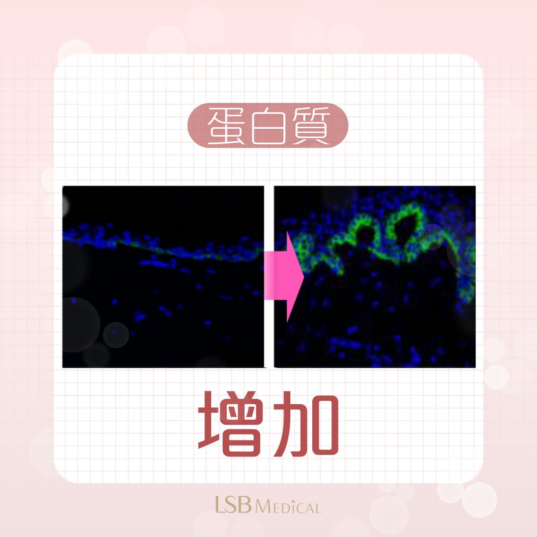 Lilied M