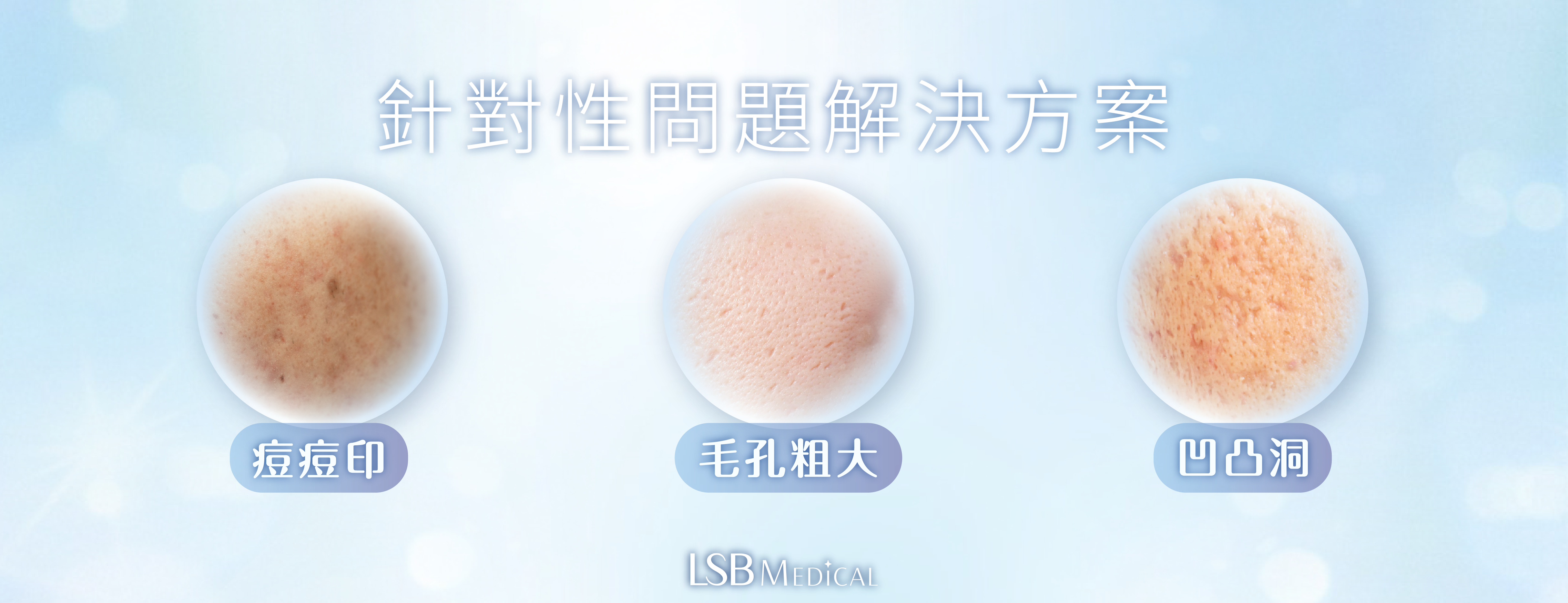 針對性問題解決方案